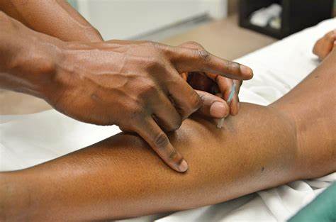 Understanding-the-Role-&-Benefits-of-Dry-Needling